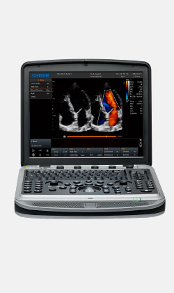 SONOBOOK 9 УЗИ аппарат экспертного класса