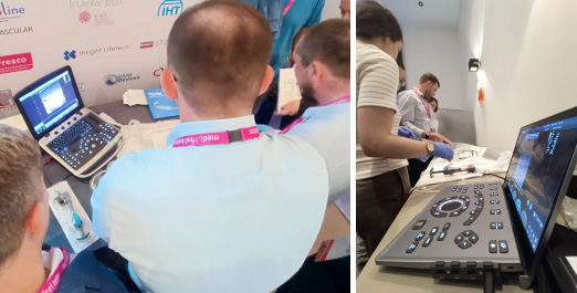 ANGIO PICTURE 2025 CHISON сосудистый доступ