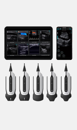 SONOTOUCH 30 SONOEYE УЗИ аппарат