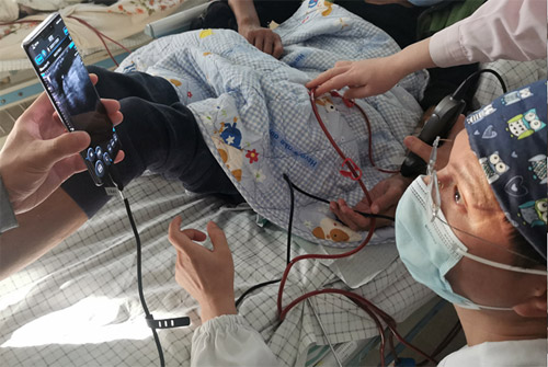 CHISON Sonotouch 30 Sonoeye Планшетный УЗИ сканер