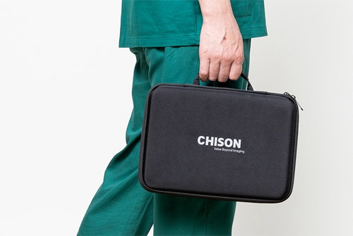 CHISON Sonotouch 30 Sonoeye Планшетный УЗИ сканер