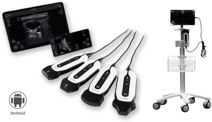 CHISON Sonotouch 30 (Sonoeye) планшетный УЗИ сканер