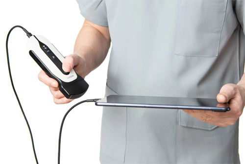 CHISON Sonotouch 30 Sonoeye Планшетный УЗИ сканер